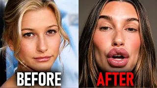 Celebrities Are LYING About Plastic Surgery Before After Photos