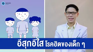 โรคอีสุกอีใสเกิดจากอะไร และมีลักษณะอาการอย่างไรบ้าง