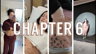 Tummy Tuck Journey - Final Chapter Q A Continued
