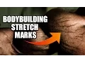 Bodybuilding Stretch Marks Can They Be Eliminated