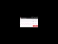 Android ECG Demo