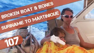 Our Worst Sailing Passage Yet: Broken Auto Pilot and Broken Bones Ep 107