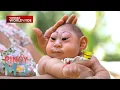 Download Lagu Sanggol, ipinanganak na maliit ang ulo o may kondisyong microcephaly | Pinoy MD
