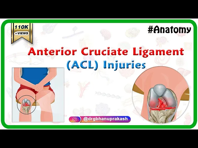 Anterior Cruciate Ligament (ACL) Injuries
