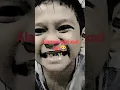 Download Lagu Gigi hilang