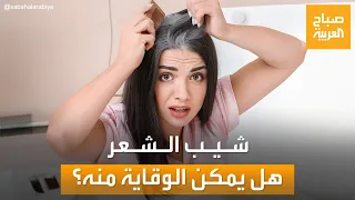 أسباب وراء شيب الشعر في سن مبكرة   وما هي طرق العلاج  دندنها