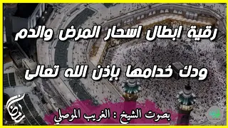 رقية سحر التمريض وأسحار المرض بدعاء قوي بإذن الله تعالى الشيخ الغريب الموصلي 