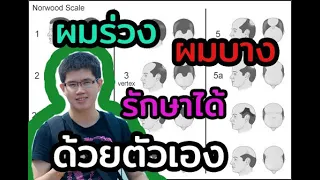 สาเหตุหลักของผมร่วงตามกรรมพันธุ์และฮอร์โมนคืออะไร และมีลักษณะอาการต่างกันอย่างไรระหว่างเพศชายกับเพศหญิง