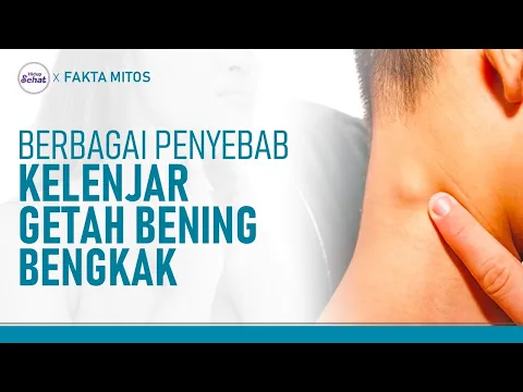 Kelenjar Getah Bening Bengkak? Ini Penyebabnya