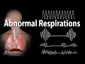 Abnormal breathing patterns Kussmaul Biot s Cheyne-Stokes respirations and More Animation