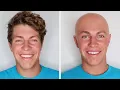 I Went Bald