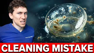 How to Clean Contact Lenses (Don't Skip This!)
