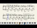 Download Lagu Eliza Simpkins by Theron C. Bennett (1904)