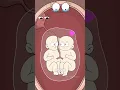 How Do Conjoined Twins Form
