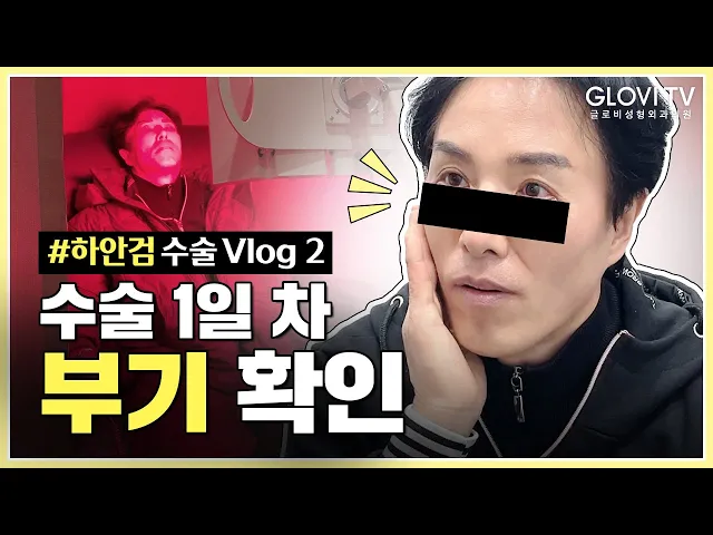 수술 1일 차! 부기 확인하고 가세요~ #하안검 Vlog2