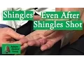 Download Lagu Shingles on the Hand Even After Shingles Shot | Auburn Medical Group