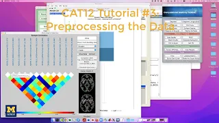 CAT12 Tutorial Preprocessing