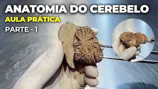 Cerebelo