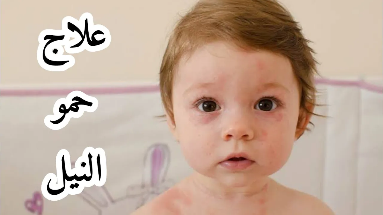 طريقة ناجحة لصناعة خل تفاح طبيعي و صحي في المنزل حتى من تفاح تالف و به عفن https://youtu.be/-2QUL5GM. 