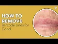 How to Remove Barcode Lines for Good Skin Body Concerns