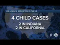 What parents should know as 5th child tests positive for monkeypox in US