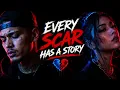 Every Scar Has a Story | Emotional Rap