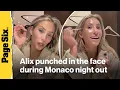 Alix Earle punched in the face during Monaco night out