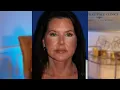 Facelift Testimonial Lynn s Story Dr Sang Kim Natural Face Clinic