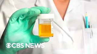 Record number of U S workers cheating on drug tests Quest Diagnostics finds