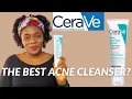 Cerave Acne Foaming Cream Cleanser Review Dr Janet