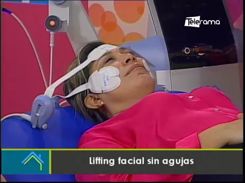 Lifting facial sin agujas