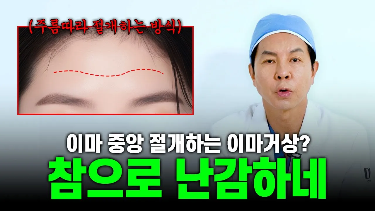이마 정중앙에 절개를 하는 이마거상이 더 효과적이라고?? #이마거상