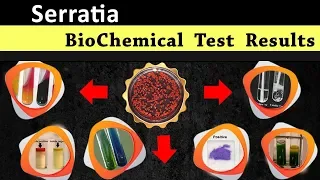 Serratia Biochemical test results