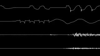 Super Mario RPG From Inside The Earthen Pipe Oscilloscope View 