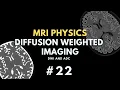 Download Lagu Diffusion Weighted Imaging (DWI) and Apparent Diffusion Coefficient (ADC) | MRI Physics Course #22