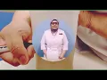 Step by step guide for 24-hour urine collection