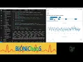 Enhancing EEG Data Visualization Developing an Intuitive Web Application