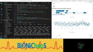 Enhancing EEG Data Visualization Developing an Intuitive Web Application