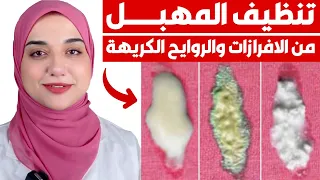 الافرازات المهبلية و انواعها حسب لونها وصفة للتخلص من الالتهابات المهبلية و رائحة المهبل الكريهة 