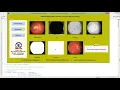 Diabetic Retinopathy Detection Using Image Processing Matlab Project Code