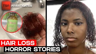 Mielle Organics UNDER FIRE After Consumers Claim Their Products Cause HAIR LOSS TSR Investigates