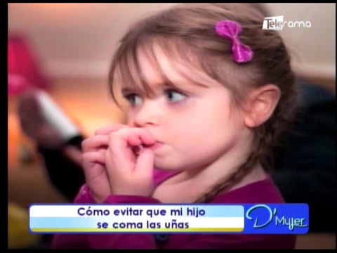 Cómo evitar que mi hijo se coma las uñas
