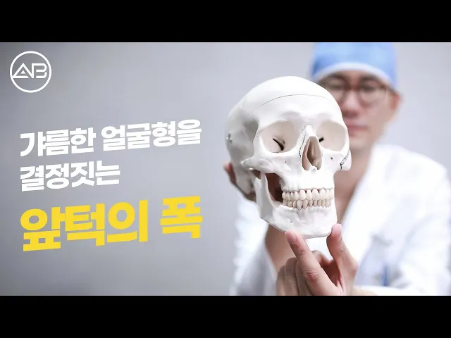 안면윤곽수술 중 정면효과 원한다면? V라인만들기 앞턱수술 종류와 수술방법