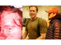 Jimmy Was Shot In The Head