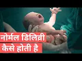Download Lagu Normal Delivery Kaise Hoti Hai | Normal Delivery In Jaipur | Dr. Mayuri Kothiwala