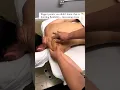 Deep Deep Tissue Massage With A Model