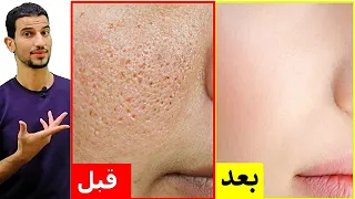The Fastest Way To Get Rid Of Large Pores And Oily Skin In Just 3 Days 