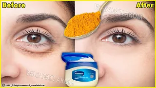 Download In just 3 days it removes wrinkles and bags under the eyes completely, Dark Circle, Puffy Eyes MP3