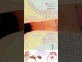 Download Lagu Journey of Sound in 15 seconds 👂 Sound waves into electricity ⚡ Medical arts official 🔊