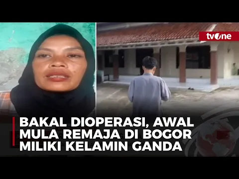 Bakal Dioperasi, Awal Mula Remaja di Bogor Ketahuan Berganti Kelamin